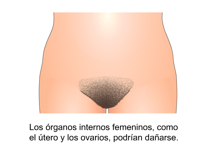 Los rganos internos femeninos, como el tero y los ovarios, podran daarse.