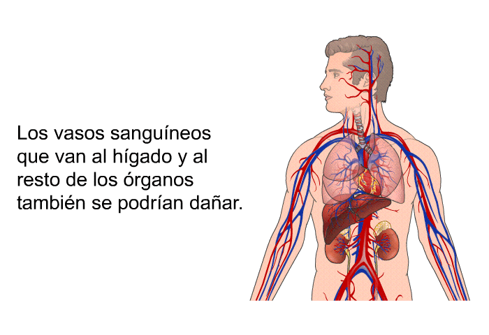 Los vasos sanguneos que van al hgado y al resto de los rganos tambin se podran daar.