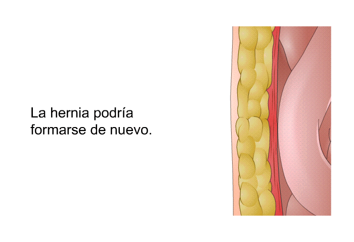 La hernia podra formarse de nuevo.