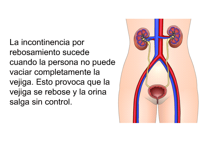 La incontinencia por rebosamiento sucede cuando la persona no puede vaciar completamente la vejiga. Esto provoca que la vejiga se rebose y la orina salga sin control.