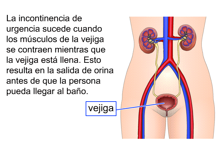La incontinencia de urgencia sucede cuando los msculos de la vejiga se contraen mientras que la vejiga est llena. Esto resulta en la salida de orina antes de que la persona pueda llegar al bao.