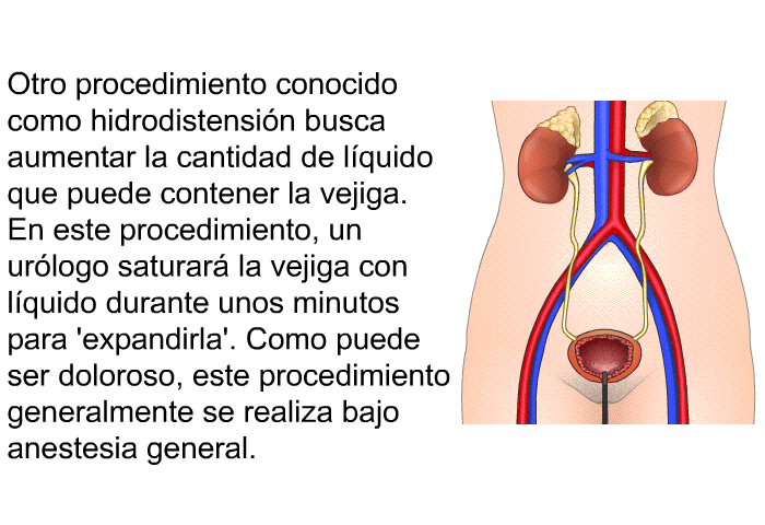 Otro procedimiento conocido como hidrodistensin busca aumentar la cantidad de lquido que puede contener la vejiga. En este procedimiento, un urlogo saturar la vejiga con lquido durante unos minutos para  expandirla'. Como puede ser doloroso, este procedimiento generalmente se realiza bajo anestesia general.