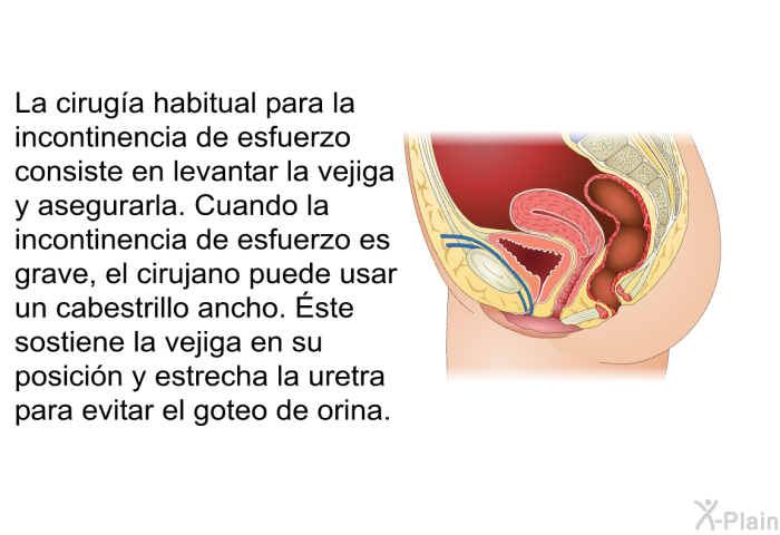La ciruga habitual para la incontinencia de esfuerzo consiste en levantar la vejiga y asegurarla. Cuando la incontinencia de esfuerzo es grave, el cirujano puede usar un cabestrillo ancho. Éste sostiene la vejiga en su posicin y estrecha la uretra para evitar el goteo de orina.