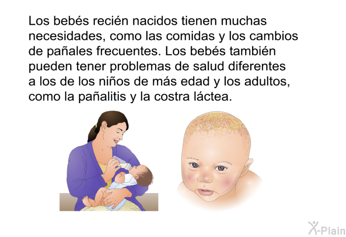 Los bebs recin nacidos tienen muchas necesidades, como las comidas y los cambios de paales frecuentes. Los bebs tambin pueden tener problemas de salud diferentes a los de los nios de ms edad y los adultos, como la paalitis y la costra lctea.