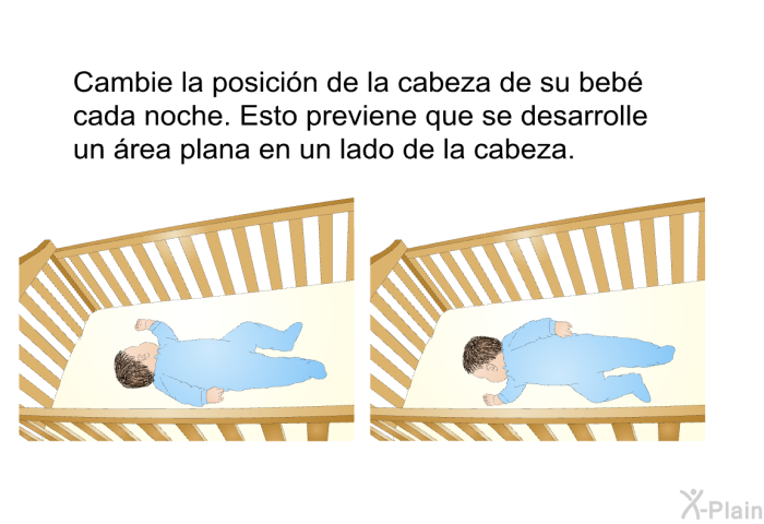 Cambie la posicin de la cabeza de su beb cada noche. Esto previene que se desarrolle un rea plana en un lado de la cabeza.
