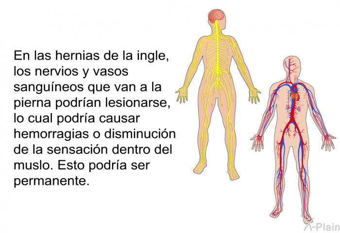 En las hernias de la ingle, los nervios y vasos sanguneos que van a la pierna podran lesionarse, lo cual podra causar hemorragias o disminucin de la sensacin dentro del muslo. Esto podra ser permanente.