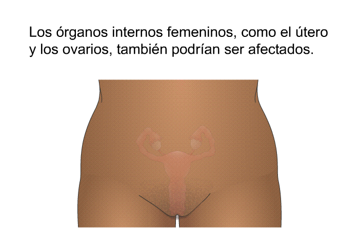 Los �rganos internos femeninos, como el �tero y los ovarios, tambi�n podr�an ser afectados.