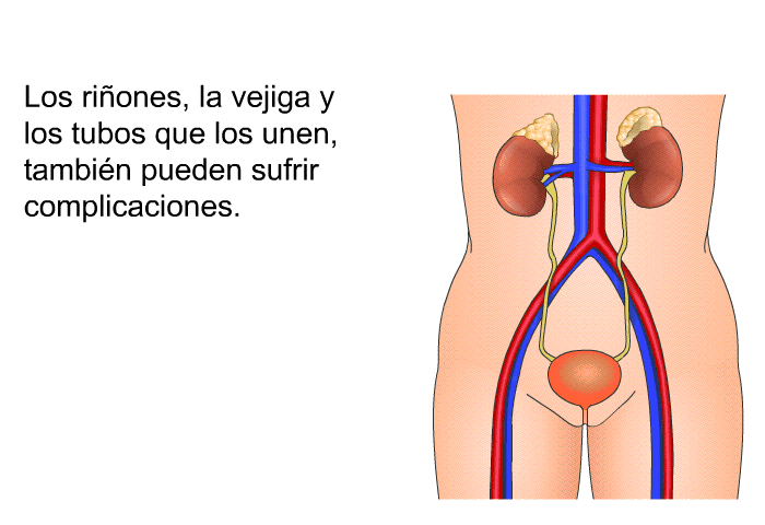 Los ri�ones, la vejiga y los tubos que los unen, tambi�n pueden sufrir complicaciones.