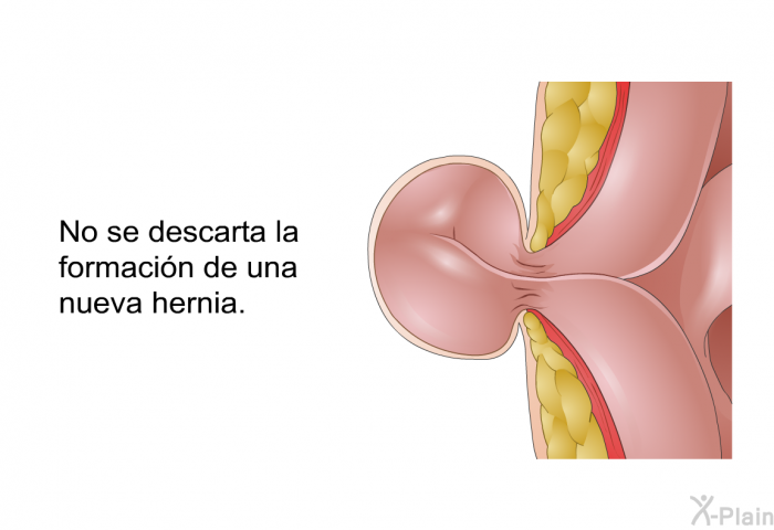 No se descarta la formacin de una nueva hernia.