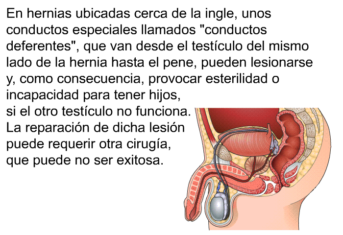 En hernias ubicadas cerca de la ingle, unos conductos especiales llamados “conductos deferentes”, que van desde el testculo del mismo lado de la hernia hasta el pene, pueden lesionarse y, como consecuencia, provocar esterilidad o incapacidad para tener hijos, si el otro testculo no funciona. La reparacin de dicha lesin puede requerir otra ciruga, que puede no ser exitosa.