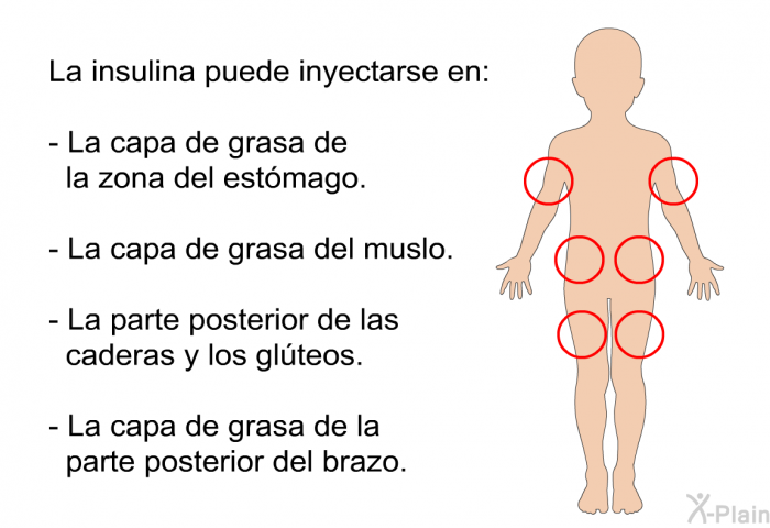 La insulina puede inyectarse en:  La capa de grasa de la zona del estmago. La capa de grasa del muslo. La parte posterior de las caderas y los glteos. La capa de grasa de la parte posterior del brazo.