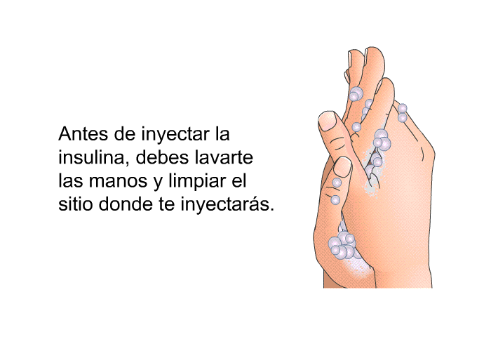 Antes de inyectar la insulina, debes lavarte las manos y limpiar el sitio donde te inyectars.