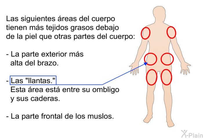 Las siguientes reas del cuerpo tienen ms tejidos grasos debajo de la piel que otras partes del cuerpo:  La parte exterior ms alta del brazo. Las “llantas.” Esta rea est entre su ombligo y sus caderas. La parte frontal de los muslos.
