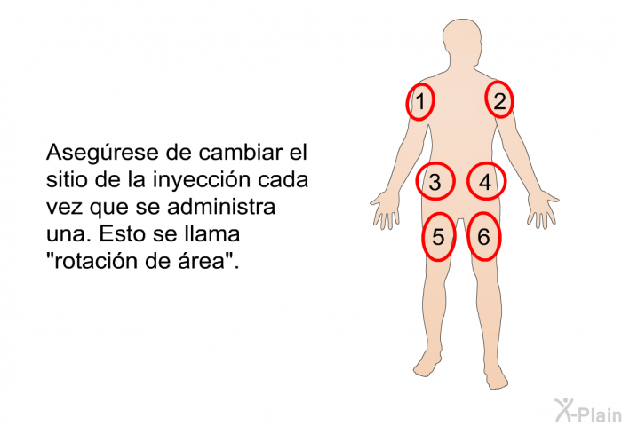 Asegrese de cambiar el sitio de la inyeccin cada vez que se administra una. Esto se llama “rotacin de rea”.
