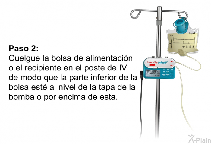 <B>Paso 2:</B> 
 Cuelgue la bolsa de alimentacin o el recipiente en el poste de IV de modo que la parte inferior de la bolsa est al nivel de la tapa de la bomba o por encima de esta.