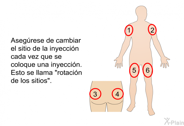 Asegrese de cambiar el sitio de la inyeccin cada vez que se coloque una inyeccin. Esto se llama “rotacin de los sitios”.