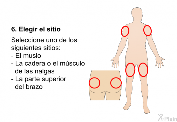 Elegir el sitio  Seleccione uno de los siguientes sitios:  El muslo La cadera o el msculo de las nalgas La parte superior del brazo