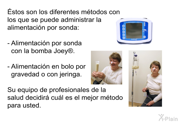 Éstos son los diferentes mtodos con los que se puede administrar la alimentacin por sonda:  Alimentacin por sonda con la bomba Joey<SUP> </SUP>. Alimentacin en bolo por gravedad o con jeringa.  
 Su equipo de profesionales de la salud decidir cul es el mejor mtodo para usted.