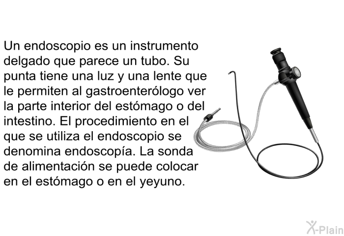 Un endoscopio es un instrumento delgado que parece un tubo. Su punta tiene una luz y una lente que le permiten al gastroenterlogo ver la parte interior del estmago o del intestino. El procedimiento en el que se utiliza el endoscopio se denomina <I>endoscopa</I>. La sonda de alimentacin se puede colocar en el estmago o en el yeyuno.