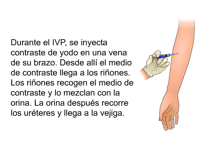 Durante el IVP, se inyecta contraste de yodo en una vena de su brazo. Desde all el medio de contraste llega a los riones. Los riones recogen el medio de contraste y lo mezclan con la orina. La orina despus recorre los urteres y llega a la vejiga.