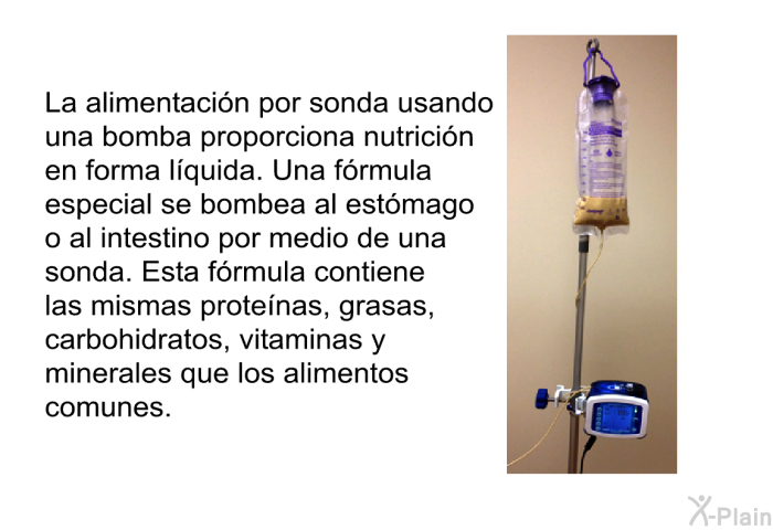 La alimentacin por sonda usando una bomba proporciona nutricin en forma lquida. Una frmula especial se bombea al estmago o al intestino por medio de una sonda. Esta frmula contiene las mismas protenas, grasas, carbohidratos, vitaminas y minerales que los alimentos comunes.