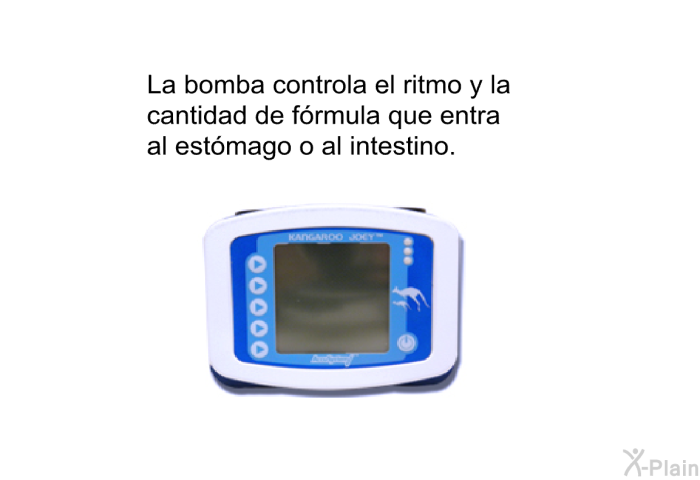 La bomba controla el ritmo y la cantidad de frmula que entra al estmago o al intestino.