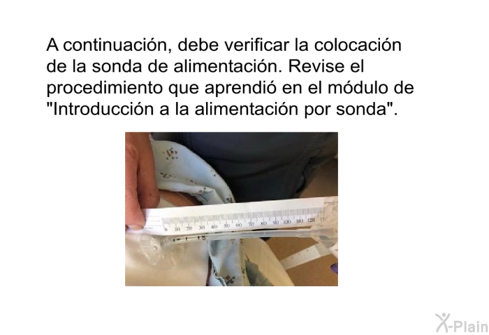 A continuacin, debe verificar la colocacin de la sonda de alimentacin. Revise el procedimiento que aprendi en el mdulo de “Introduccin a la alimentacin por sonda”.