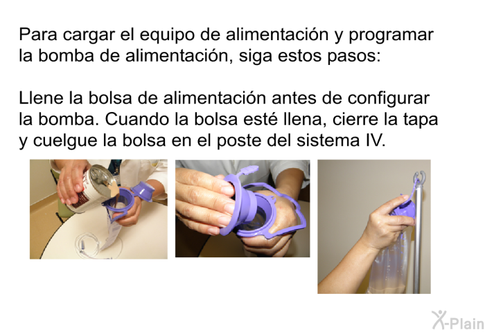 Para cargar el equipo de alimentacin y programar la bomba de alimentacin, siga estos pasos: Llene la bolsa de alimentacin antes de configurar la bomba. Cuando la bolsa est llena, cierre la tapa y cuelgue la bolsa en el poste del sistema IV.