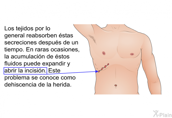 Los tejidos por lo general reabsorben stas secreciones despus de un tiempo. En raras ocasiones, la acumulacin de stos fluidos puede expandir y abrir la incisin. Este problema se conoce como dehiscencia de la herida.