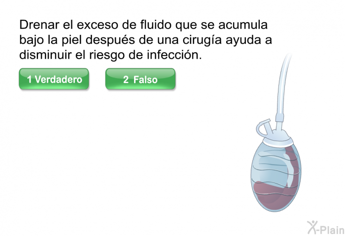 Drenar el exceso de fluido que se acumula bajo la piel despus de una ciruga ayuda a disminuir el riesgo de infeccin.