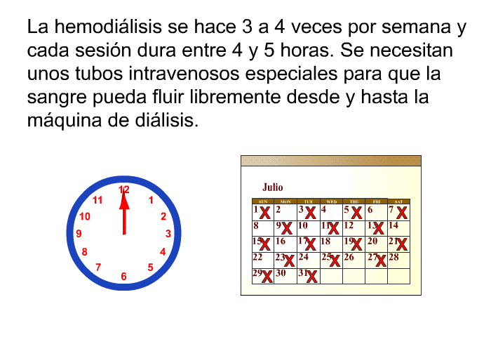 La hemodi�lisis se hace 3 a 4 veces por semana y cada sesi�n dura entre 4 y 5 horas. Se necesitan unos tubos intravenosos especiales para que la sangre pueda fluir libremente desde y hasta la m�quina de di�lisis.