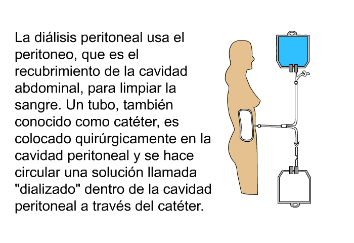 La di�lisis peritoneal usa el peritoneo, que es el recubrimiento de la cavidad abdominal, para limpiar la sangre. Un tubo, tambi�n conocido como cat�ter, es colocado quir�rgicamente en la cavidad peritoneal y se hace circular una soluci�n llamada &ldquo;dializado&rdquo; dentro de la cavidad peritoneal a trav�s del cat�ter.
