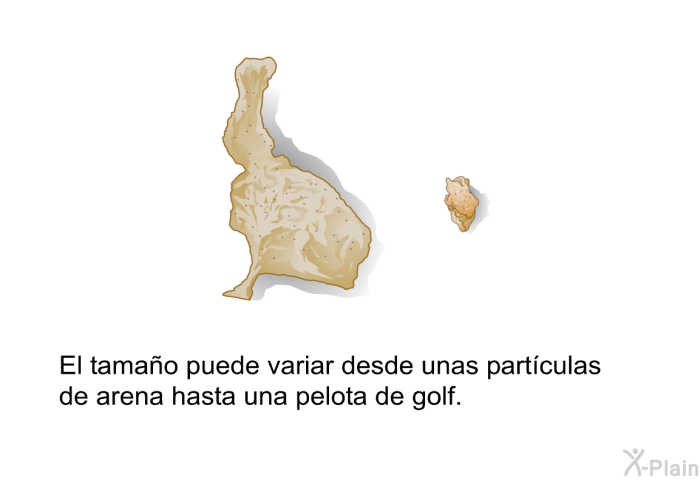 El tamao puede variar desde unas partculas de arena hasta una pelota de golf.