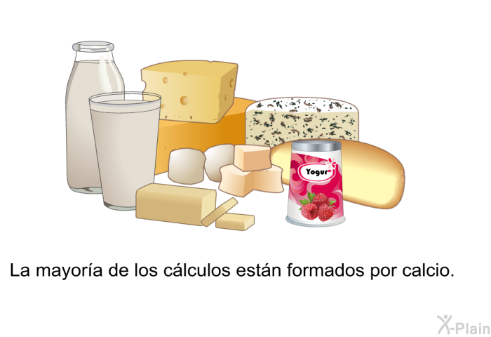 La mayora de los clculos estn formados por calcio.