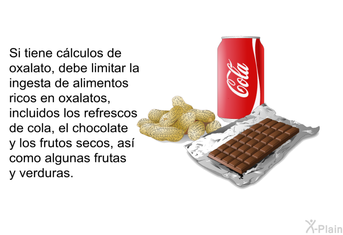 Si tiene c�lculos de oxalato, debe limitar la ingesta de alimentos ricos en oxalatos, incluidos los refrescos de cola, el chocolate y los frutos secos, as� como algunas frutas y verduras.