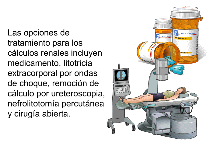 Las opciones de tratamiento para los c�lculos renales incluyen medicamento, litotricia extracorporal por ondas de choque, remoci�n de c�lculo por ureteroscopia, nefrolitotom�a percut�nea y cirug�a abierta.