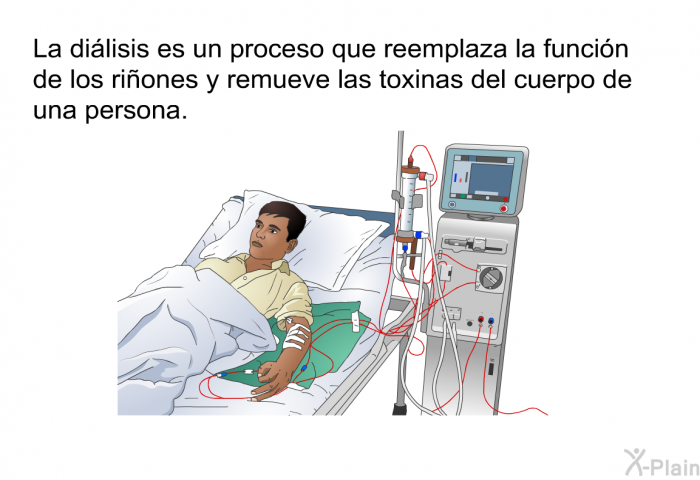 La dilisis es un proceso que reemplaza la funcin de los riones y remueve las toxinas del cuerpo de una persona.