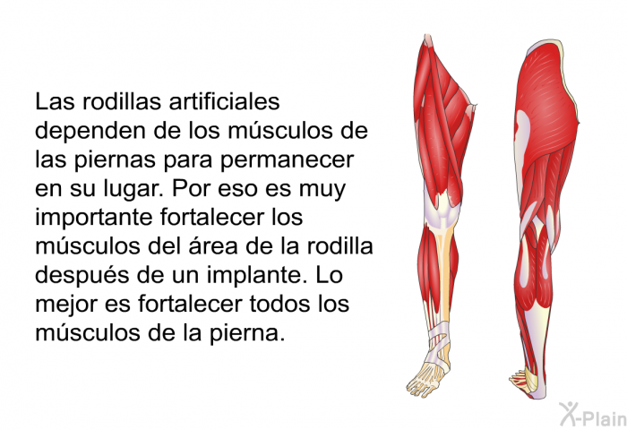 Las rodillas artificiales dependen de los msculos de las piernas para permanecer en su lugar. Por eso es muy importante fortalecer los msculos del rea de la rodilla despus de un implante. Lo mejor es fortalecer todos los msculos de la pierna.