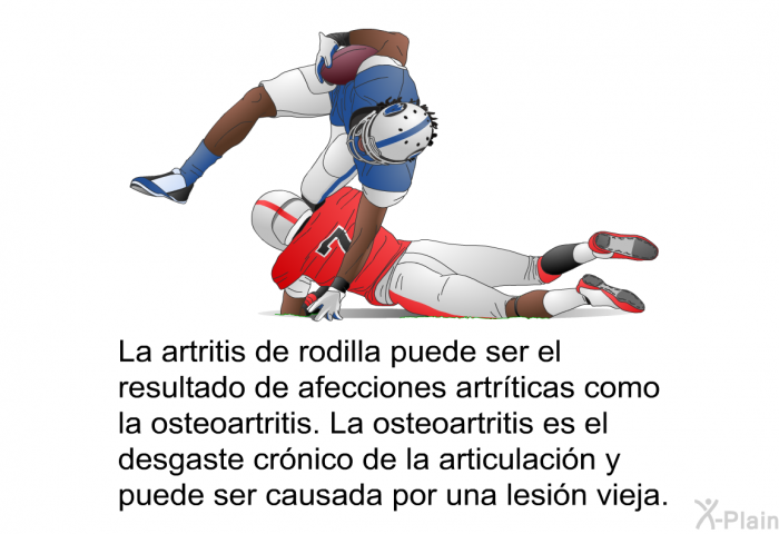 La artritis de rodilla puede ser el resultado de afecciones artrticas como la osteoartritis. La osteoartritis es el desgaste crnico de la articulacin y puede ser causada por una lesin vieja.