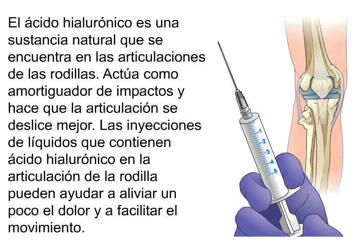 El �cido hialur�nico es una sustancia natural que se encuentra en las articulaciones de las rodillas. Act�a como amortiguador de impactos y hace que la articulaci�n se deslice mejor. Las inyecciones de l�quidos que contienen �cido hialur�nico en la articulaci�n de la rodilla pueden ayudar a aliviar un poco el dolor y a facilitar el movimiento.