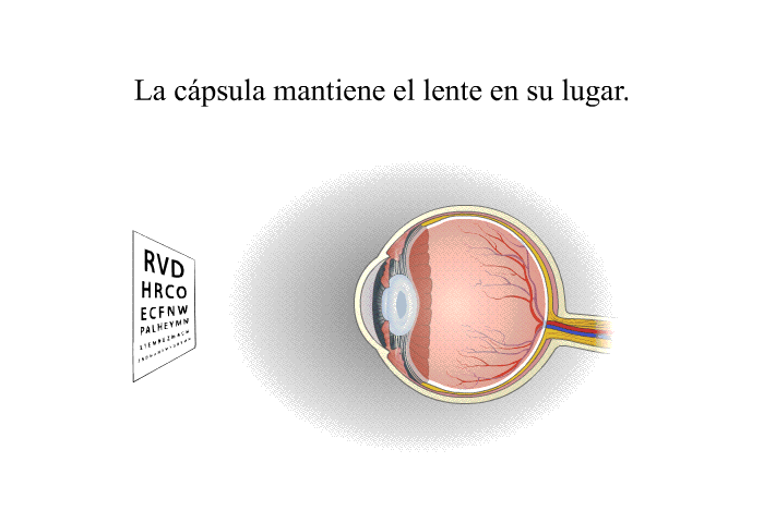 La cpsula mantiene el lente en su lugar.