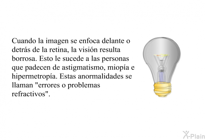 Cuando la imagen se enfoca delante o detrs de la retina, la visin resulta borrosa. Esto le sucede a las personas que padecen de astigmatismo, miopa e hipermetropa. Estas anormalidades se llaman “errores o problemas refractivos”.