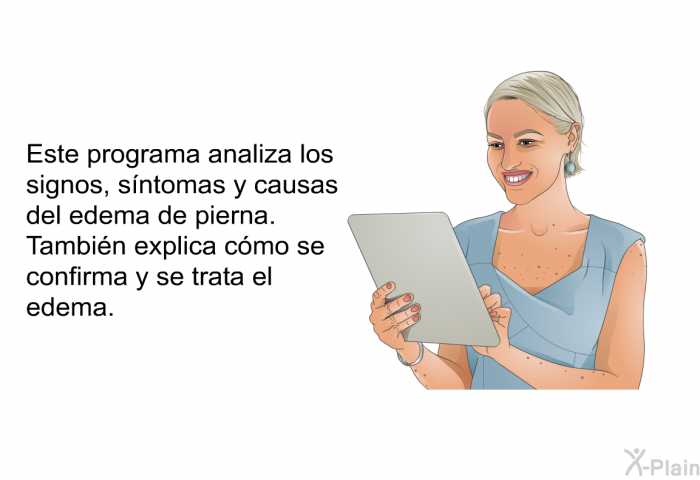 Esta informacin acerca de su salud analiza los signos, sntomas y causas del edema de pierna. Tambin explica cmo se confirma y se trata el edema.