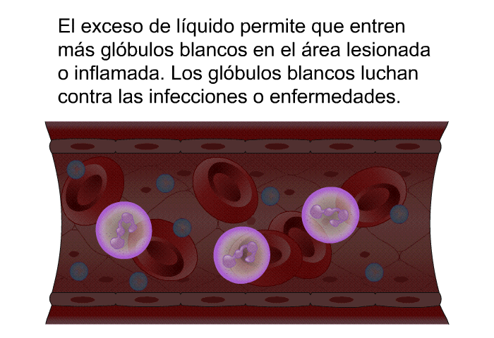 El exceso de lquido permite que entren ms glbulos blancos en el rea lesionada o inflamada. Los glbulos blancos luchan contra las infecciones o enfermedades.
