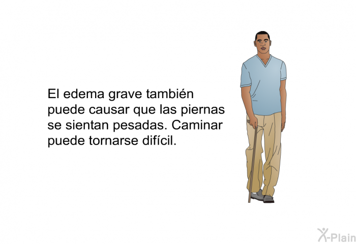 El edema grave tambin puede causar que las piernas se sientan pesadas. Caminar puede tornarse difcil.