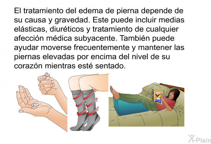 El tratamiento del edema de pierna depende de su causa y gravedad. Este puede incluir medias el�sticas, diur�ticos y tratamiento de cualquier afecci�n m�dica subyacente. Tambi�n puede ayudar moverse frecuentemente y mantener las piernas elevadas por encima del nivel de su coraz�n mientras est� sentado.