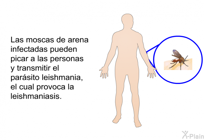 Las moscas de arena infectadas pueden picar a las personas y transmitir el parsito leishmania, el cual provoca la leishmaniasis.