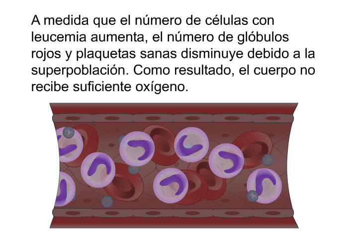 A medida que el nmero de clulas con leucemia aumenta, el nmero de glbulos rojos y plaquetas sanas disminuye debido a la superpoblacin. Como resultado, el cuerpo no recibe suficiente oxgeno.