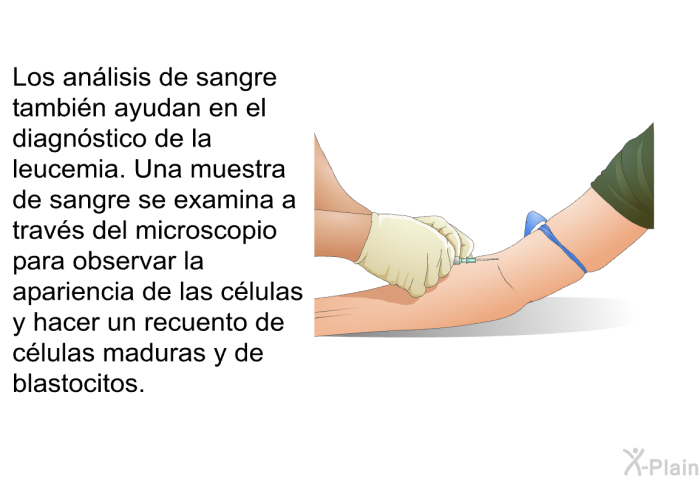 Los an�lisis de sangre tambi�n ayudan en el diagn�stico de la leucemia. Una muestra de sangre se examina a trav�s del microscopio para observar la apariencia de las c�lulas y hacer un recuento de c�lulas maduras y de blastocitos.