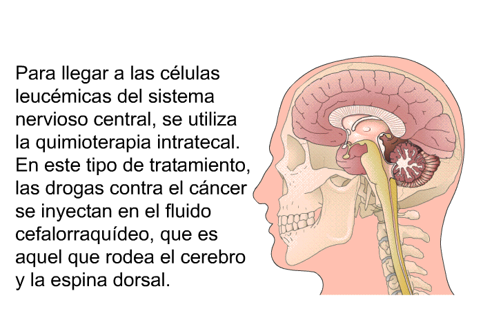Para llegar a las clulas leucmicas del sistema nervioso central, se utiliza la quimioterapia intratecal. En este tipo de tratamiento, las drogas contra el cncer se inyectan en el fluido cefalorraqudeo, que es aquel que rodea el cerebro y la espina dorsal.